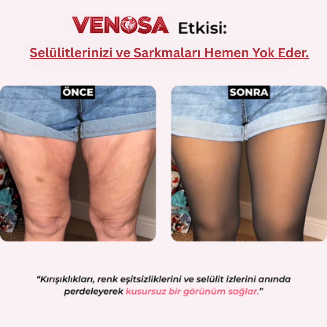Venosa®: Peluş Toparlayıcı Kışlık Tayt
