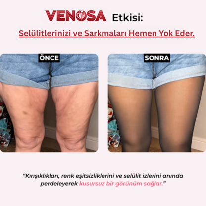 Venosa®: Peluş Toparlayıcı Kışlık Tayt